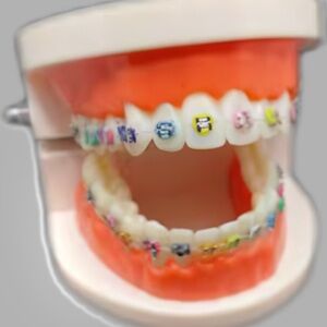 Multicolor Fashion/Removable Faux Braces with Hook Latch